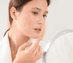 1 skin assessment consultaion 1