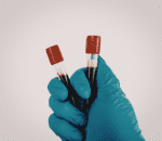 2 blood sample collection