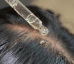 2 scalp cleaning