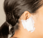 5 dressing protection