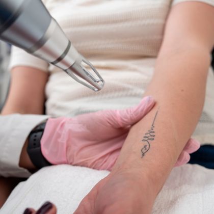 Cosmetic tattoo removal