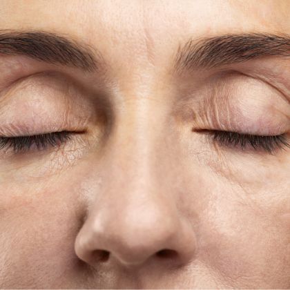 Dull tired looking skin 2