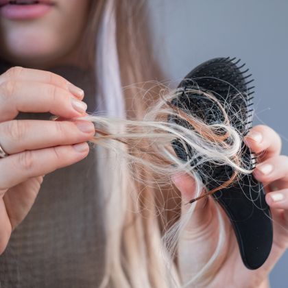 Early baldness signs