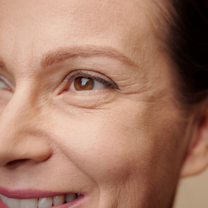 Fine lines wrinkles 3