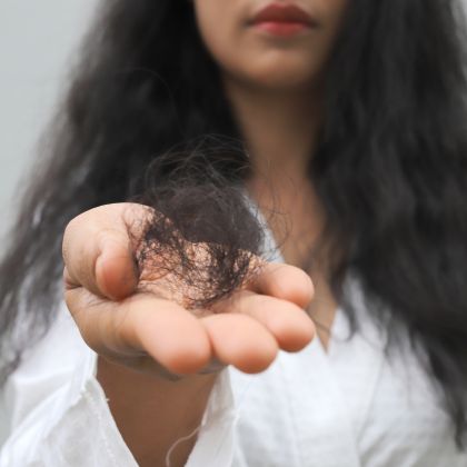 Hair fall 