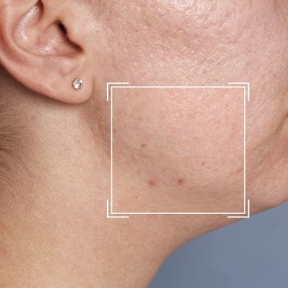 Loose facial contours