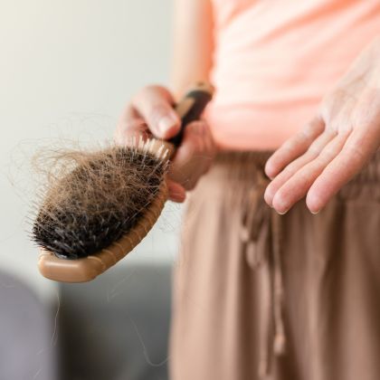 Nutritional hair loss 