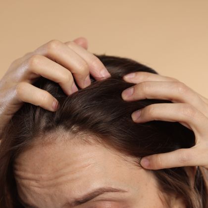 Stress related hair loss