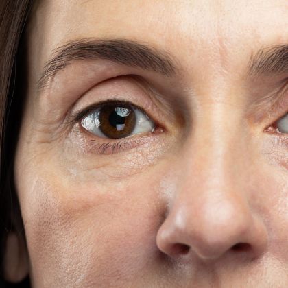 dull tired looking skin