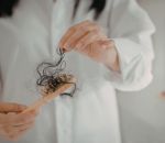 hair loss assessment