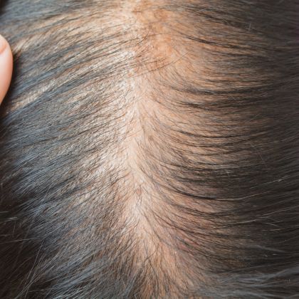 Hair Fall Weak Roots compressed