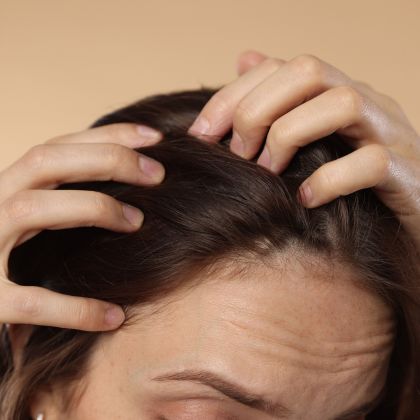 Itchy or Irritated Scalp compressed