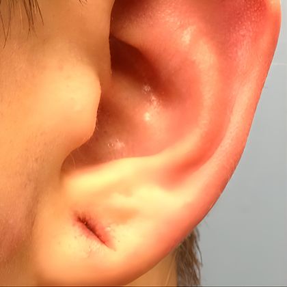 Ear12