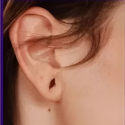 Ear13
