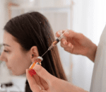 Mesotherapy for Hair Growth step 2