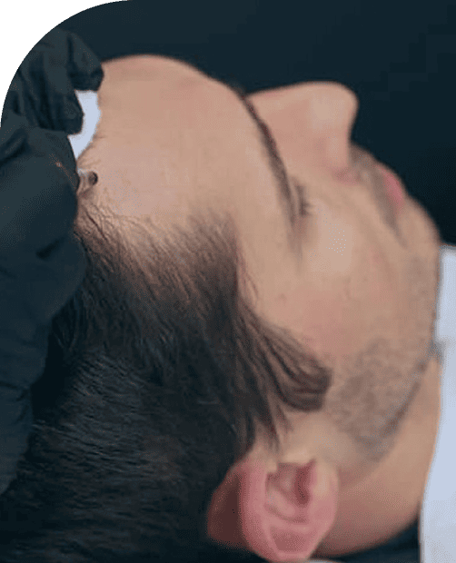 Natural Hair Simulation with Precision Care 1