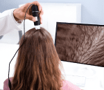 Step 1_ Hair scalp Diagnosis