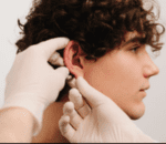 Step 2 Local Anesthesia