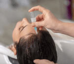 Step 2 Scalp Preparation 1