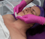 Step 2 Skin Preparation1 1